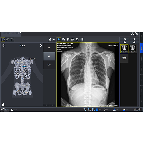 DIGITAL ACQUISITION SOFTWARE