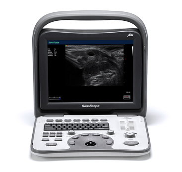 Color Doppler Ultrasound  Portable Systems 