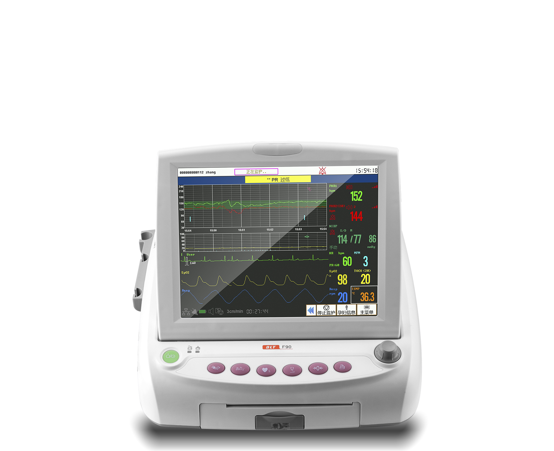 Fetal Monitor 12 inch - Twin FHR 