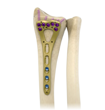 Trauma Comprehensive Solutions