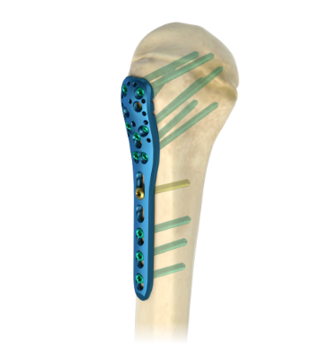 Trauma Comprehensive Solutions