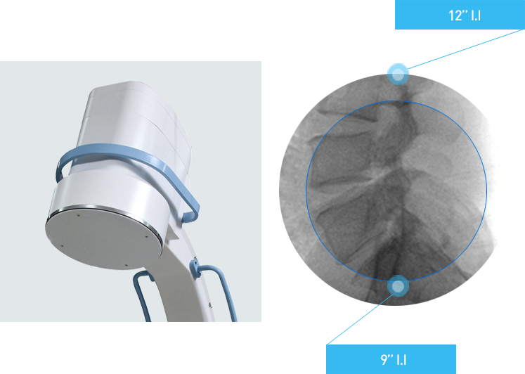 Image Intensifier C-Arm