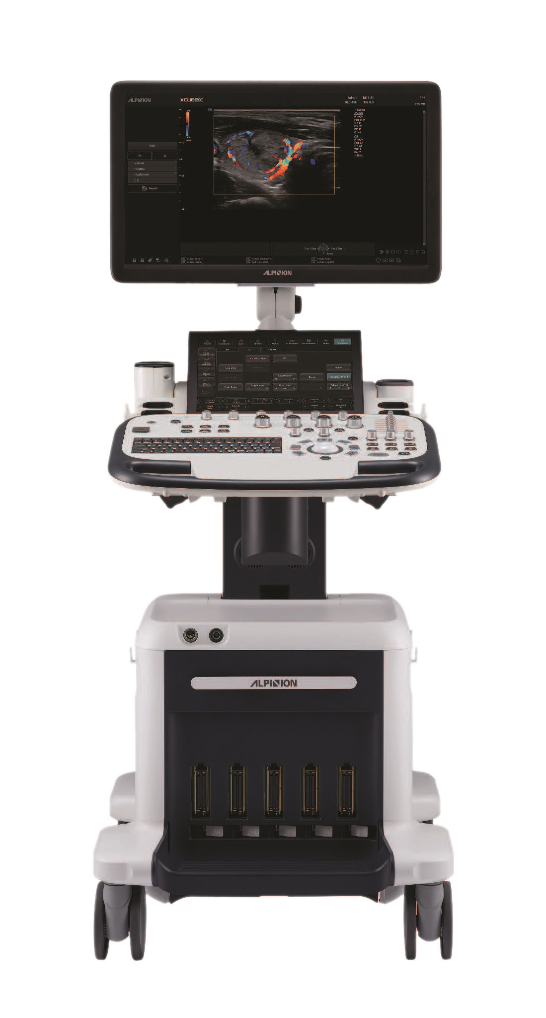 On-platform ultrasound system 