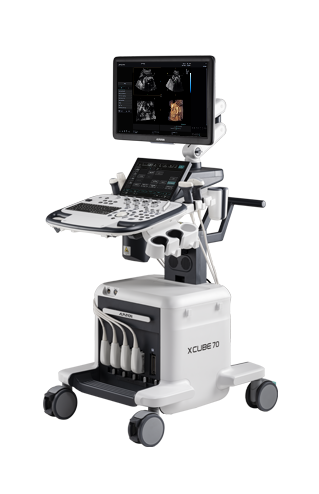 On-platform ultrasound system