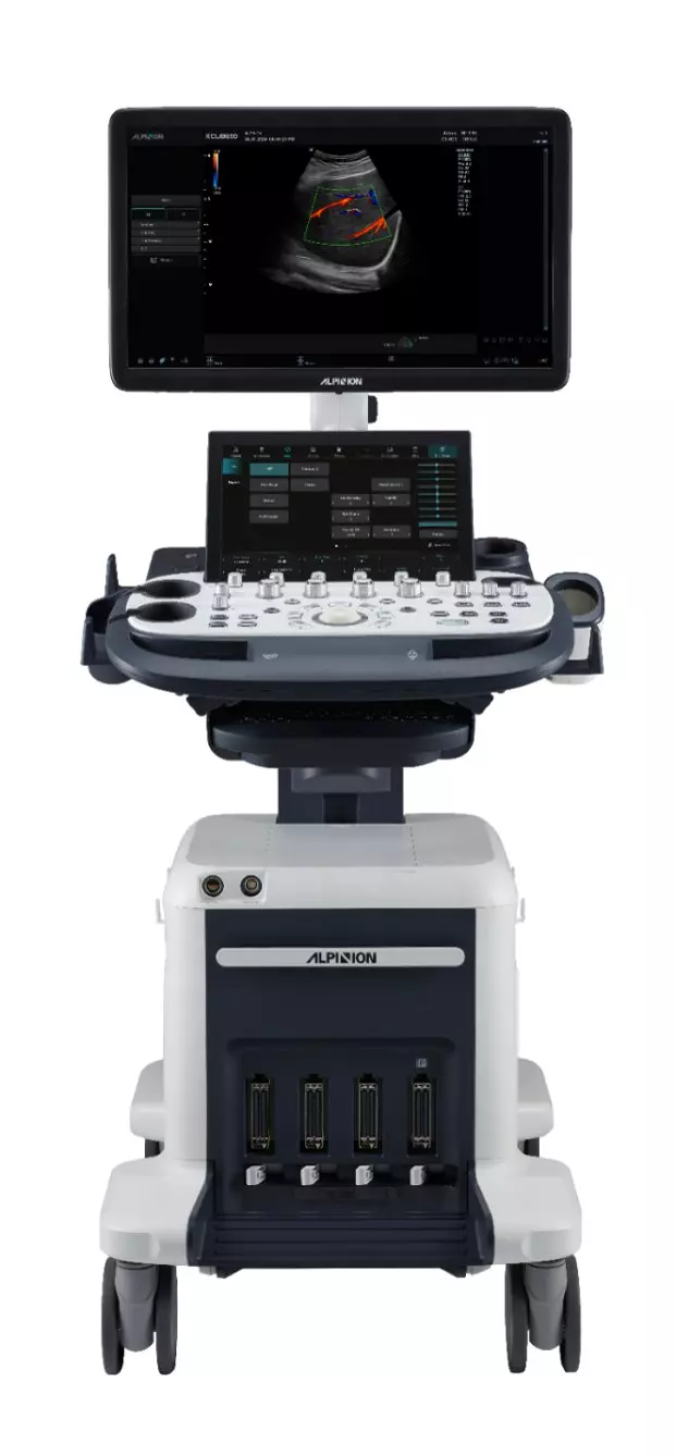 On-platform ultrasound system