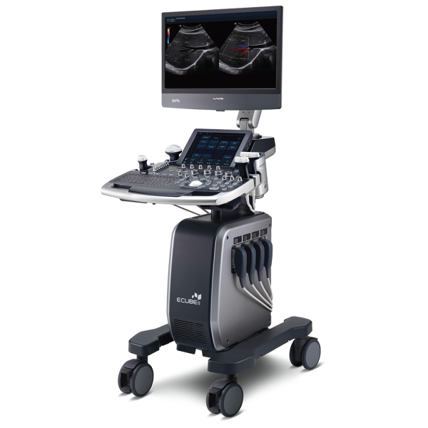 On-platform ultrasound system