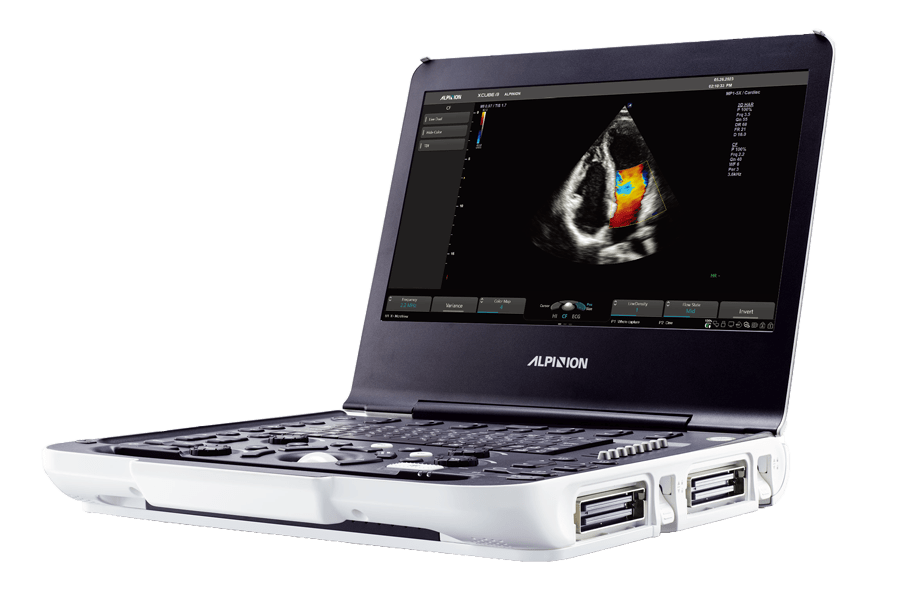 Portable Ultrasound System
