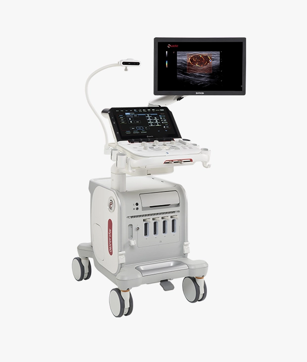 High performance console ultrasound system