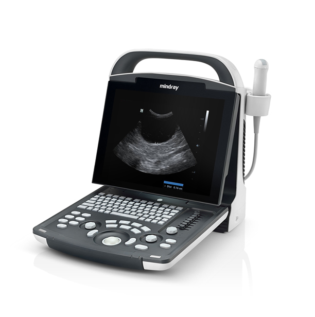 Digital Ultrasound Diagnostic Imaging System 