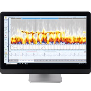 Sophisticated and precise Holter recording analysis