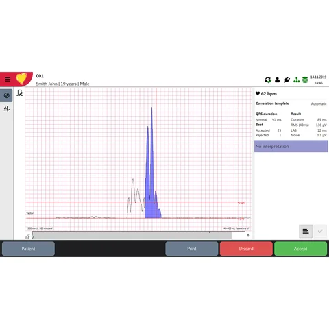 Analysis of Signal-Averaged ECG